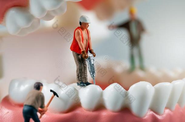 牙齿的治疗观念-小型的小雕像向牙模型