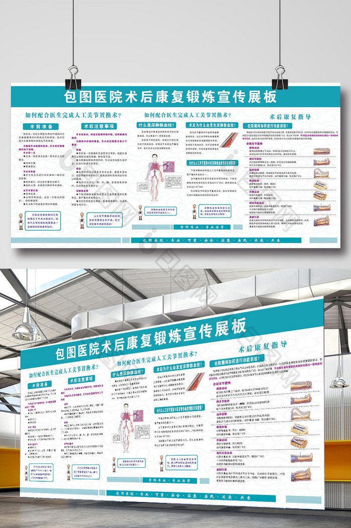 医院术后康复锻炼宣传展板设计