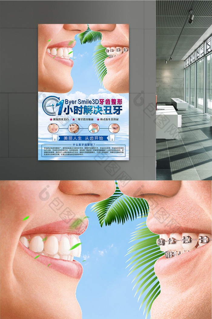 专业牙科宣传广告海报