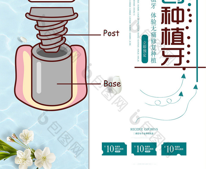 小清新无痛微创种植牙宣传海报设计