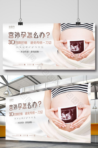 简约妇科宫外孕四彩维超医疗专题展板图片