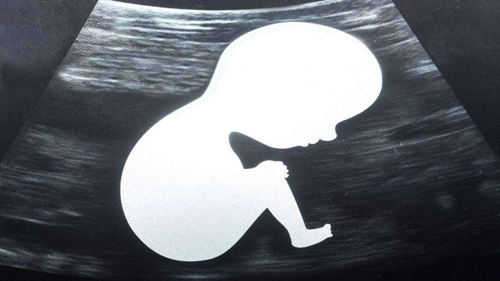 超声波婴儿胎心跳动音效卡通音效行为音效