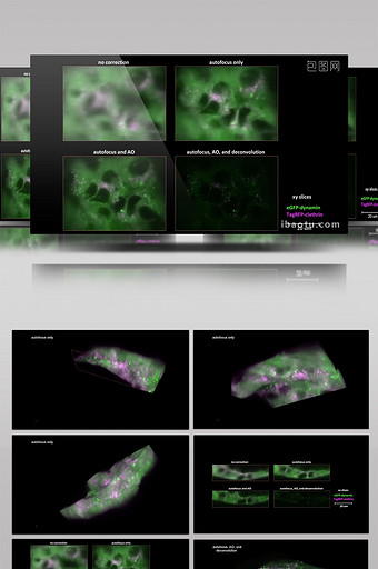 科技素材癌症影像医疗视频图片