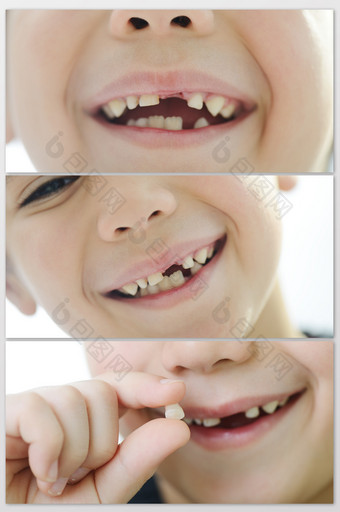 儿童换大牙图片过程图图片