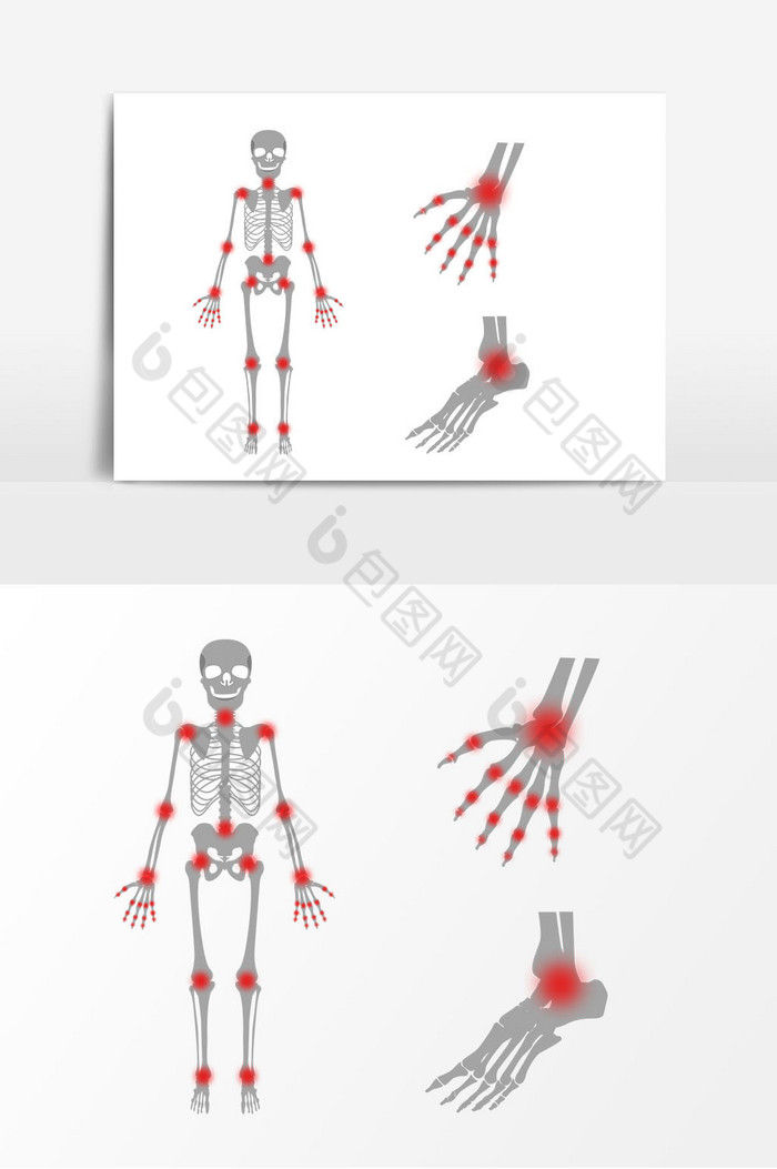 人体关节图片图片