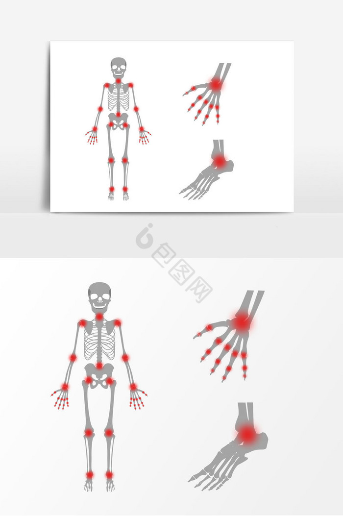 人体关节图片