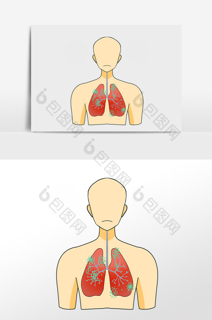 疫情肺炎症状插画图片图片