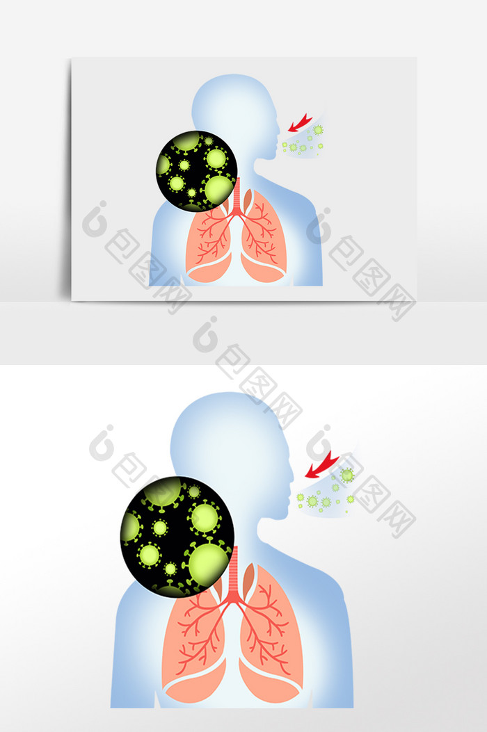 冠状病毒肺炎抗击疫情