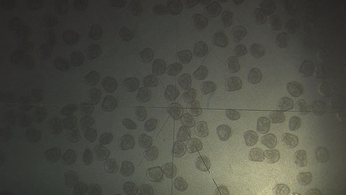 实拍显微镜下观察扇贝D形幼虫活动视频