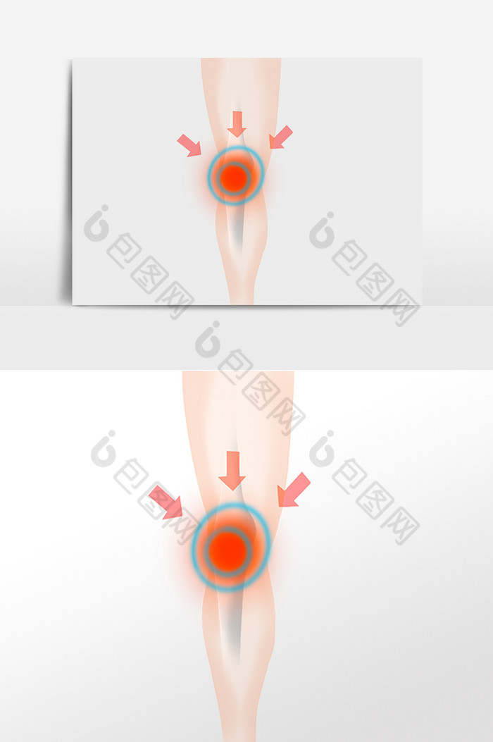 膝盖关节疼痛病痛图片图片