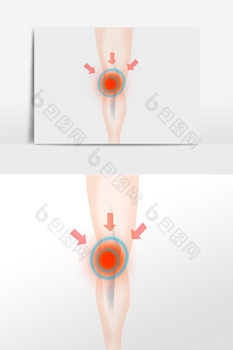 膝盖关节疼痛病痛图片