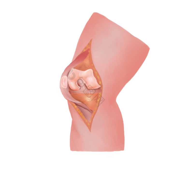 膝关节人骨胳膝盖痛图片