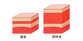 卡通肥厚脂肪皮肤示意图