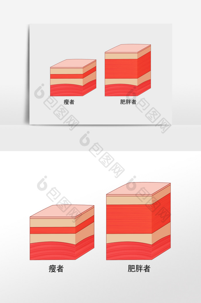 肥厚脂肪皮肤示意图图片图片