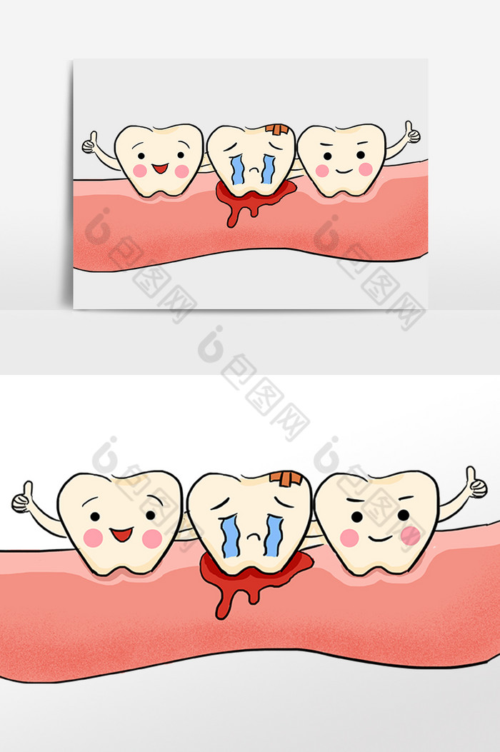 牙龈齿牙痛牙周炎图片图片