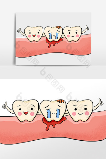 牙龈齿牙痛牙周炎图片