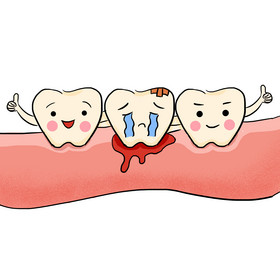 牙龈齿牙痛牙周炎