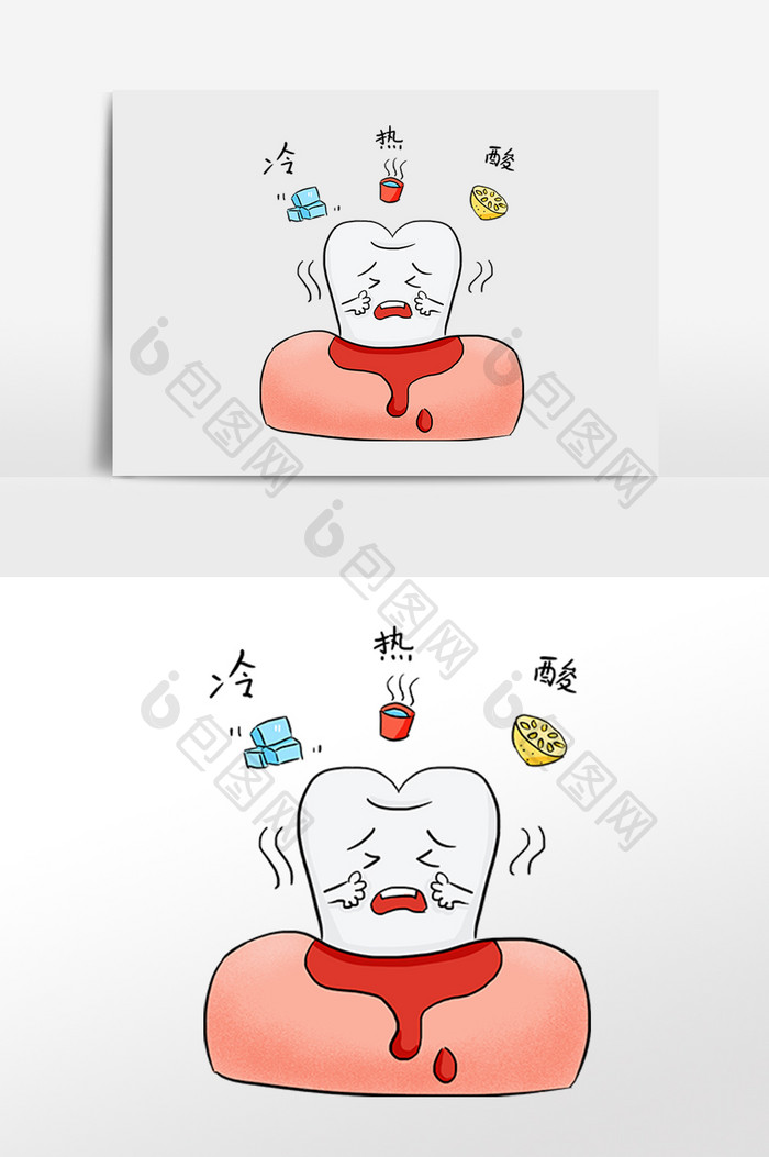 牙科牙齿牙周炎发炎