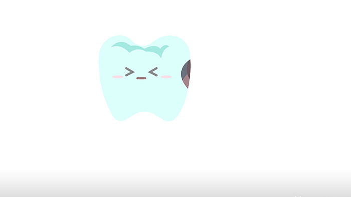 简约扁平画风医疗类牙齿蛀牙mg动画