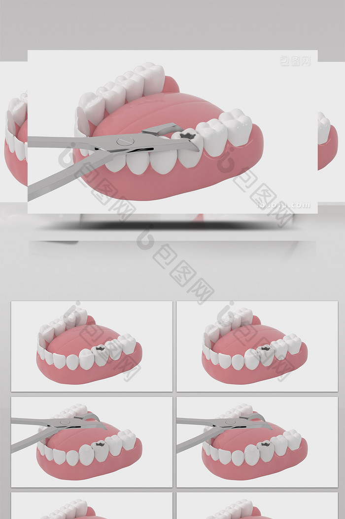 4K牙医牙科拔牙治疗高清背景视频