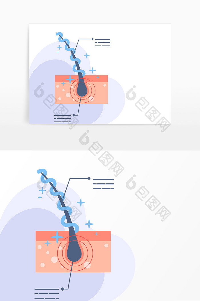 卡通手绘脱发掉发毛发