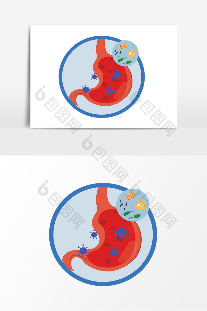 扁平化胃部疾病元素