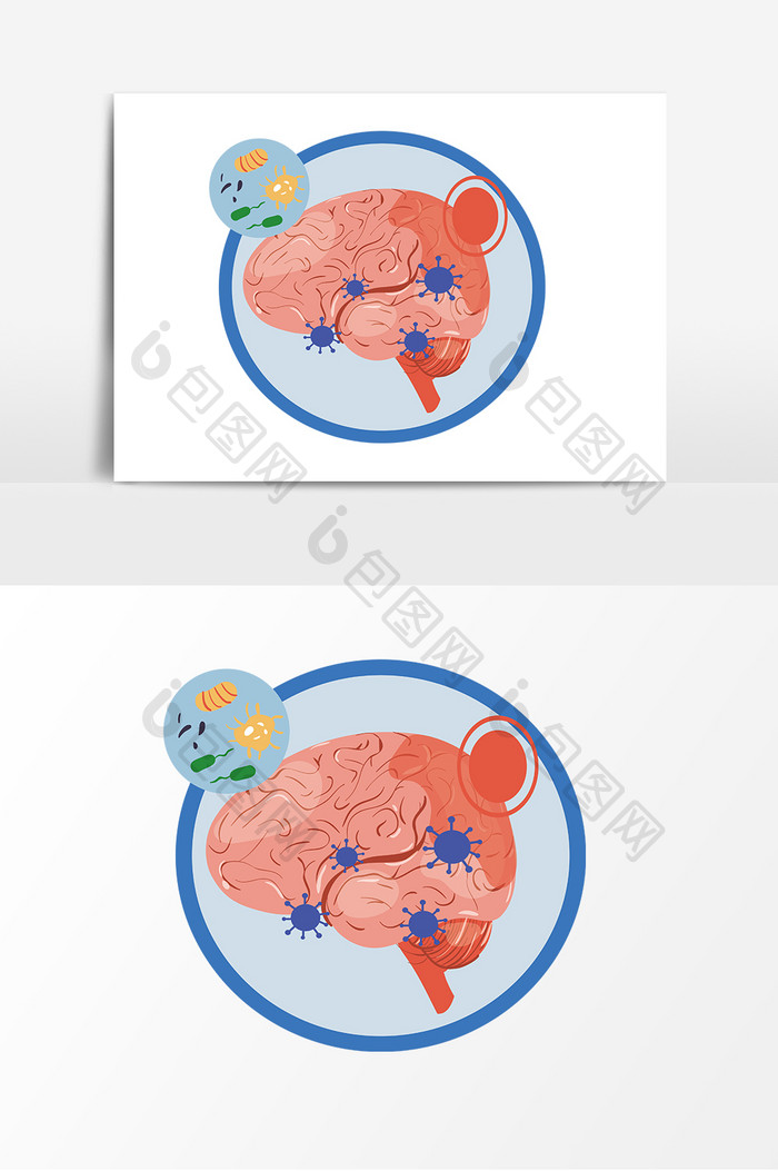 扁平化脑部疾病元素