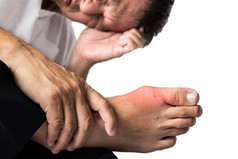 大脚趾周围有疼痛和发炎的痛风的人.