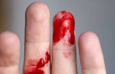 受伤的手指，手臂的血液，出血