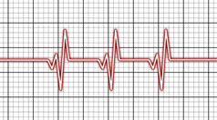心电图-医疗的概念
