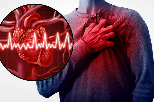 人的心脏攻击痛苦<strong>作为</strong>解剖学医学疾病概念与人遭受心脏病<strong>作为</strong>痛苦冠状动脉事件以3d 例证样式元素.