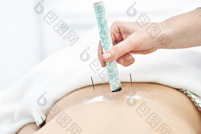 针灸治疗的妇女艾灸图片-包图网企业站