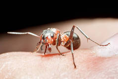 蚂蚁咬在皮肤上。人类皮肤上的蚂蚁.