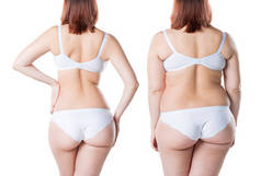 妇女的身体在减肥前后被隔绝在白色背景, 整形外科概念