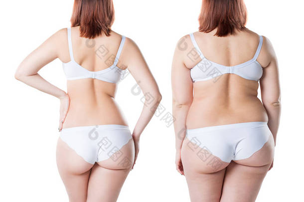 妇女的身体在减肥前后被隔绝在白色<strong>背景</strong>, <strong>整形</strong>外科概念