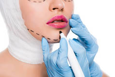 穿着蓝色乳胶手套的整形外科医生的裁剪视图, 在妇女附近拿着标记笔, 脸上有痕迹, 在白色上被隔离