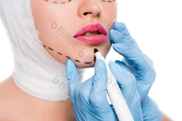 穿着蓝色乳胶手套的<strong>整形外科</strong>医生的裁剪视图, 在妇女附近拿着标记笔, 脸上有痕迹, 在白色上被隔离