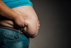 一个人的身体超重，双手接触腹部。肥胖的概念.