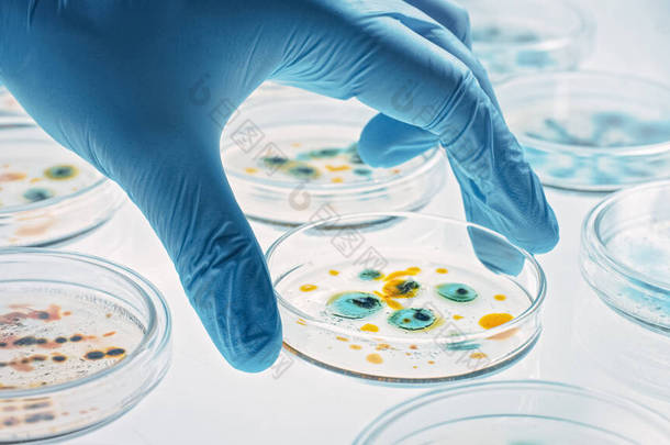 科学家与Petri Dishes一起研究各种细菌、组织和血液样本。抗生素、用DNA增强剂治疗疾病的药物研究概念。移动特写镜头