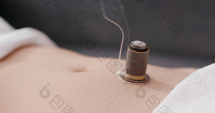 中医灸疗法艾灸图片-包图网企业站