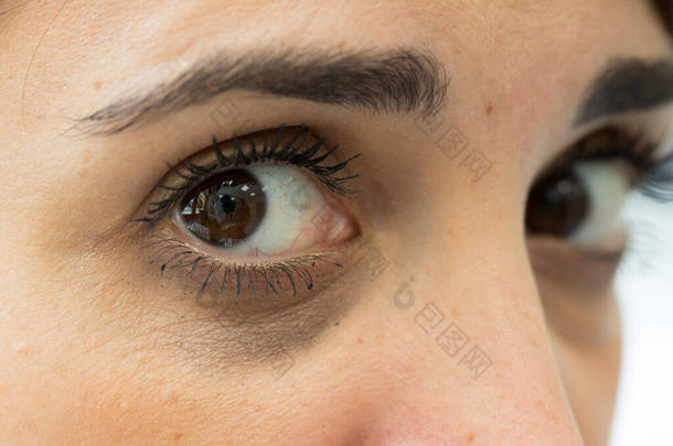 一个年轻女子的近景，她的眼睛下面有黑眼圈。因睡眠不足和<strong>长时间</strong>工作而造成的眼睛挫伤.