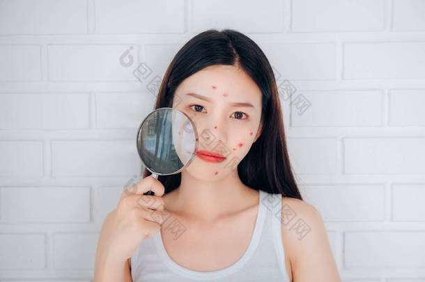 拿着放大镜的年轻亚洲妇女检查粉刺她的脸的问题.