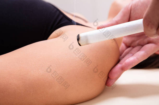 一名躺在病床上的妇女在诊所接受灸治疗的特写镜头