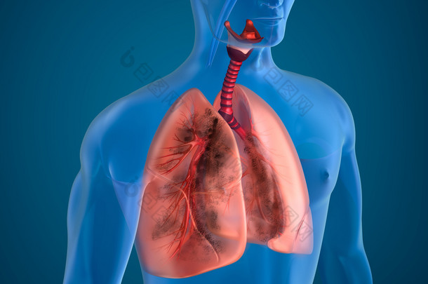 患病的肺部 x 线视图