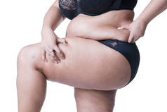 再加上大小模型在黑色内衣，超重女性的身体，大腿粗分离在白色背景上的胖女人