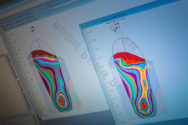 足部扫描分析的矫形器和假肢车间
