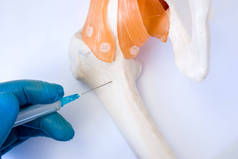 骨髓检查程序: 活检、穿刺或穿刺的概念照片。医生手里拿着手套注射器和髋骨穿刺模型进行骨髓分析