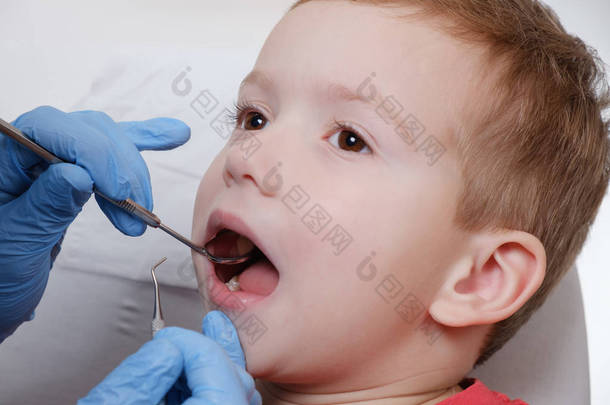 牙科医生用镜子检查<strong>儿童</strong>患者牙齿<strong>龋齿</strong>, 牙齿损伤.