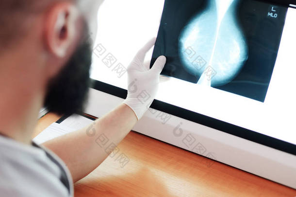 医生看照片或乳房 x 线检查-乳腺的 x-射线检测结果预防乳腺癌