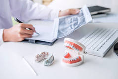 男性医生或牙医工作的病人牙 x 线胶片, 模型和设备用于牙科和牙科工作场所牙齿疾病的治疗和分析.